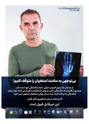 بی توجهی به سلامت استخوان